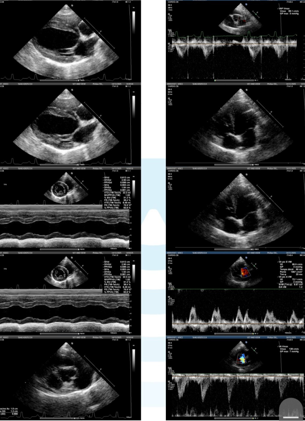 Resultat échos cardiaque